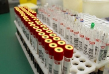 آزمایشهای تشخیص ناباروری در زنان آزمایشهای تشخیص ناباروری در زنان